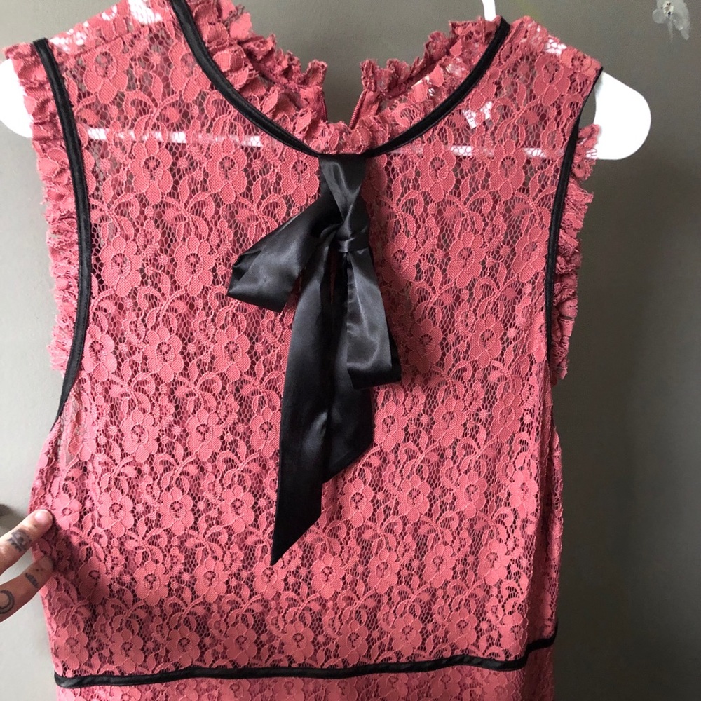 Forever 21 lace dress